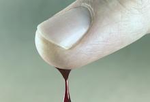 日本滴血測癌將進(jìn)入臨床研究，對13種癌癥檢測準(zhǔn)確率95%