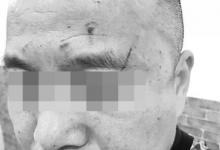 女醫生稱因不會宰病人被領導打 院長：她先動手