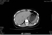 半年沒見老公太生猛，激情后她流了全身近40%的血…