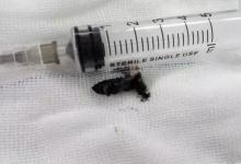 4歲寶寶睡覺打鼾，突然沒了呼吸！醫(yī)生從身上取出這東西……家長都長點心！