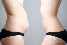 體重正常就健康？有小肚子早死風險大