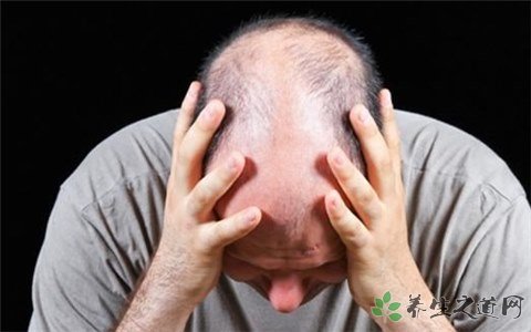 8000人報名脫發(fā)志愿者 脫發(fā)的原因有哪些