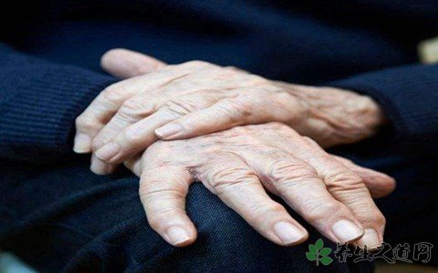 “痛風(fēng)神藥”菲布力在中國(guó)上市 痛風(fēng)的癥狀有哪些