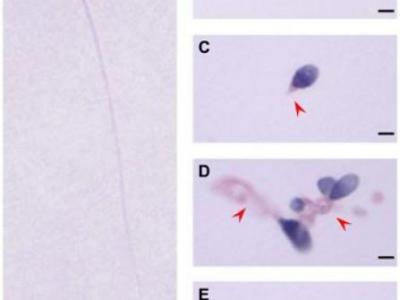 中美學者發現男性不孕不育新致病基因