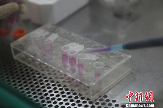 中國科學家首創I型糖尿病全新治療性DNA疫苗