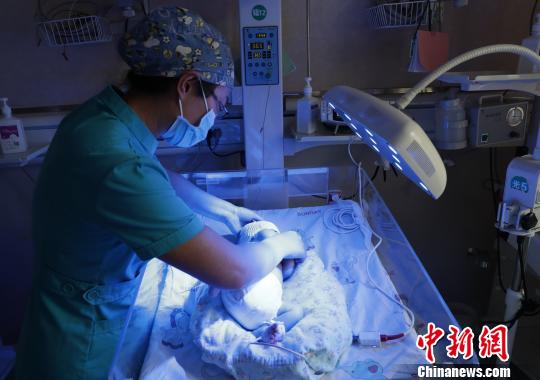 寧夏開設(shè)首個黃疸日間病房