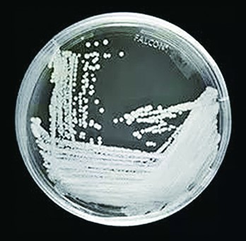 “超級真菌”來襲？這些才是真相