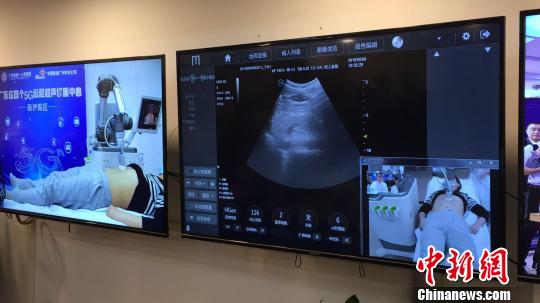 廣東省內(nèi)首例5G遠(yuǎn)程超聲診斷在廣州應(yīng)用成功