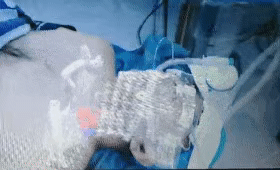 常州醫生利用MR技術做手術 宛如科幻大片