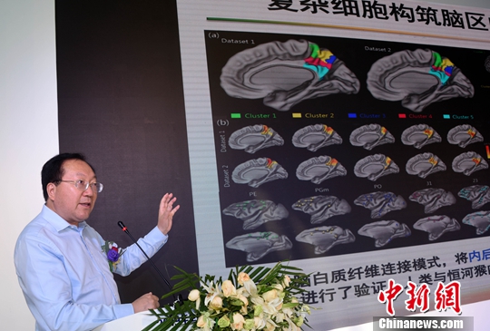 中科院自動化所腦科研成果“落地” 研發出先進腦氧檢測設備