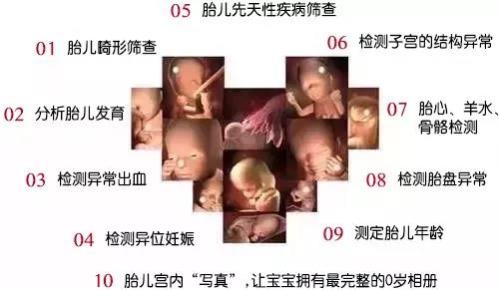 唐山寶島婦兒醫院：四維彩超檢查什么有哪些注意事項？