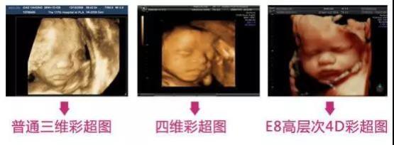 懷了雙胞胎又驚喜又擔(dān)憂，唐山寶島婦兒醫(yī)院為您保駕護(hù)航