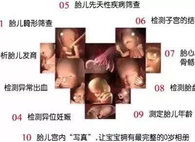 對四維彩超有疑惑，咨詢唐山寶島婦兒醫院