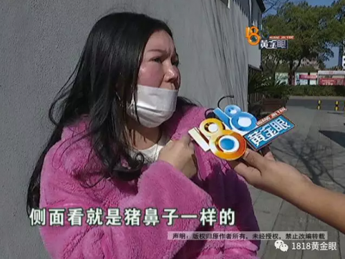 動(dòng)了三次刀 患者：湖州曙光醫(yī)療美容醫(yī)院把我鼻子做的跟豬一樣