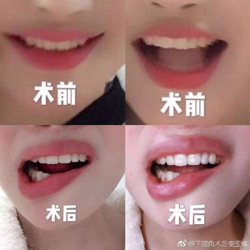 女子花3.5萬在武漢華美整形外科醫(yī)院整形致殘 院方只賠5000塊了事