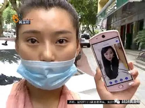 三女子整容均出現(xiàn)不同程度歪斜 義烏陽光美容醫(yī)院：本身就有問題