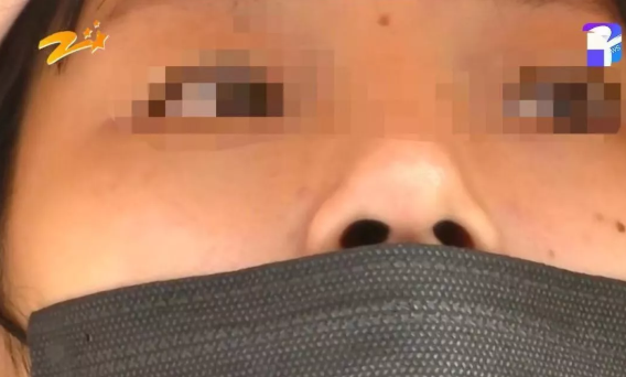杭州甄美整形醫(yī)院把人鼻子整歪了？醫(yī)院：自己長歪了