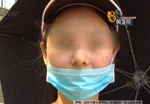 杭州畫蝶醫療美容醫院做整形 鼻子沒做好做成了豬頭鼻