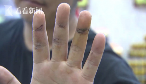 通州灣三余人民醫院為男病人配婦科用藥？院方：拿錯了