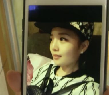 杭州美萊美容醫院把我鼻子做壞了 高價隆鼻后凹凸不平