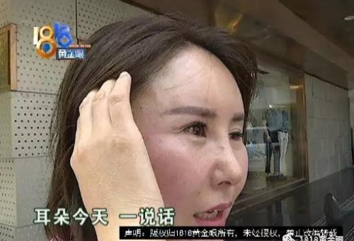 女子稱被整成了怪物 杭州格萊美醫(yī)院：藥物擴(kuò)散導(dǎo)致