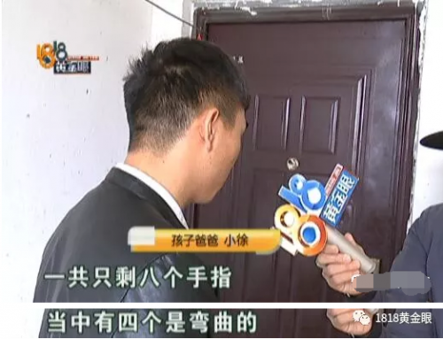 杭州余杭婦產醫院沒查出胎兒雙手畸形要不要擔責？B超能查胎兒畸形嗎？