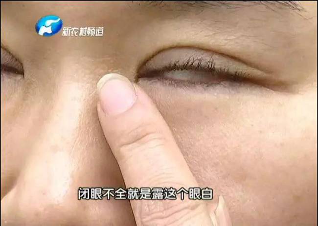 女子整形失敗 許昌華姿醫(yī)美整形醫(yī)院不認(rèn)：因?yàn)獒t(yī)生已離職