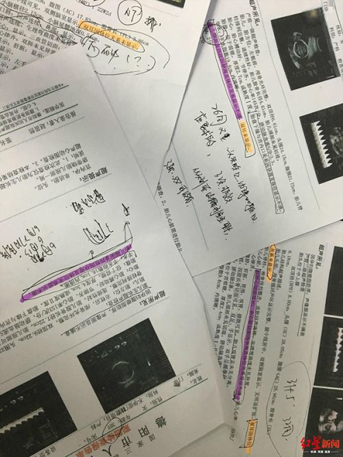 德陽市人民醫院產檢生下畸形兒:醫院稱符合診療規范 父親拒帶回家-易網健康<a href=http://www.gyfww.com/jkys/ target=_blank class=infotextkey>養生</a>網 德陽市人民醫院產檢生下畸形兒:醫院稱符合診療規范 父親拒帶回家