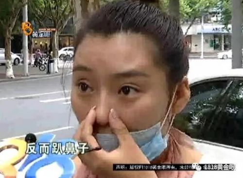 三女子整容均出現(xiàn)不同程度歪斜 義烏陽光美容醫(yī)院：本身就有問題