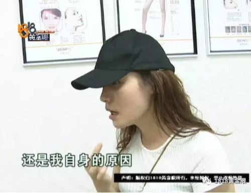 女子花4萬(wàn)多在寧波首美整形美容醫(yī)院做鼻子 術(shù)后鼻子卻像被人打過(guò)-易網(wǎng)健康養(yǎng)生網(wǎng) 女子花4萬(wàn)多在寧波首美整形美容醫(yī)院做鼻子 術(shù)后鼻子卻像被人打過(guò)