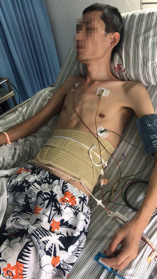 患者注射阿達木單抗注射液后感染肺結(jié)核 醫(yī)院:治療欠規(guī)范愿擔(dān)責(zé)三成