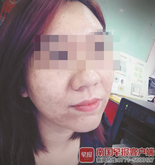 南寧華美醫院打“水光針”后悲劇了 醫生還未取得執業醫生資格證