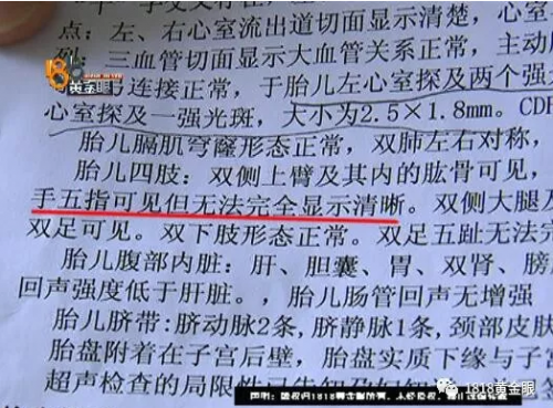 杭州余杭婦產醫院沒查出胎兒雙手畸形要不要擔責？B超能查胎兒畸形嗎？