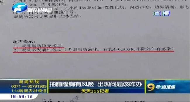 鄭州曹樂醫療整形：抽脂隆胸不靠譜 整出問題溝通難