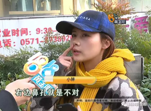 杭州愛琴海醫(yī)療美容醫(yī)院整鼻后鼻孔不對稱 朋友看到都不敢做了-易網(wǎng)健康養(yǎng)生網(wǎng) 杭州愛琴海醫(yī)療美容醫(yī)院整鼻后鼻孔不對稱 朋友看到都不敢做了