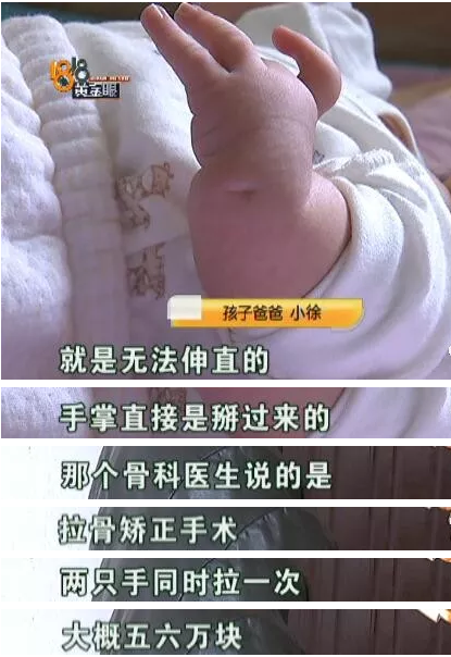 杭州余杭婦產醫院沒查出胎兒雙手畸形要不要擔責？B超能查胎兒畸形嗎？