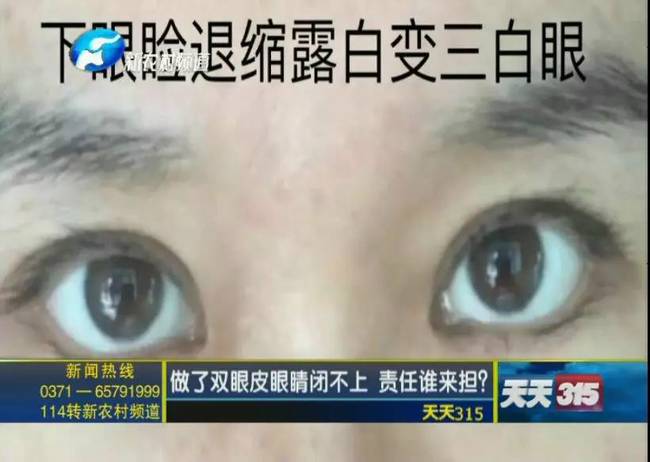 女子整形失敗 許昌華姿醫(yī)美整形醫(yī)院不認(rèn)：因?yàn)獒t(yī)生已離職