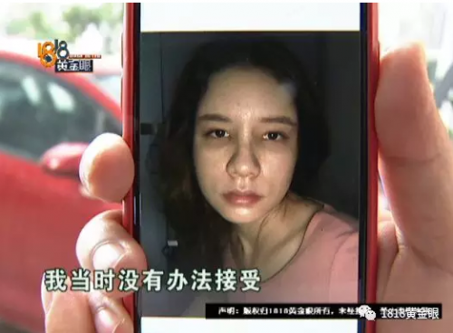 女子花4萬(wàn)多在寧波首美整形美容醫(yī)院做鼻子 術(shù)后鼻子卻像被人打過(guò)-易網(wǎng)健康<a href=http://www.gyfww.com/jkys/ target=_blank class=infotextkey>養(yǎng)生</a>網(wǎng) 女子花4萬(wàn)多在寧波首美整形美容醫(yī)院做鼻子 術(shù)后鼻子卻像被人打過(guò)