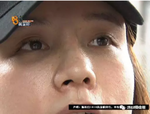 女子花4萬(wàn)多在寧波首美整形美容醫(yī)院做鼻子 術(shù)后鼻子卻像被人打過(guò)-易網(wǎng)<a href=http://www.gyfww.com/ target=_blank class=infotextkey>健康養(yǎng)生</a>網(wǎng) 女子花4萬(wàn)多在寧波首美整形美容醫(yī)院做鼻子 術(shù)后鼻子卻像被人打過(guò)