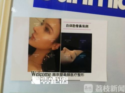 南京塑美顏整形門診涉嫌超范圍經(jīng)營 女孩隆鼻后鼻孔大小不一-易網(wǎng)健康養(yǎng)生網(wǎng) 南京塑美顏整形門診涉嫌超范圍經(jīng)營 女孩隆鼻后鼻孔大小不一