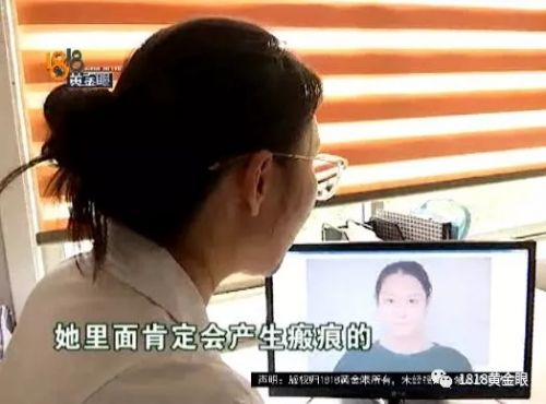 三女子整容均出現(xiàn)不同程度歪斜 義烏陽光美容醫(yī)院：本身就有問題