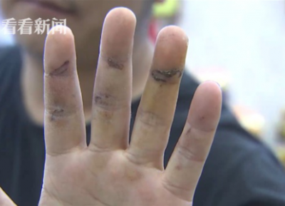 通州灣三余人民醫院為男病人配婦科用藥？院方：拿錯了