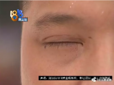 整形手術(shù)后小伙慌了！杭州靜麗醫(yī)療整形醫(yī)院：他不是我們的客戶