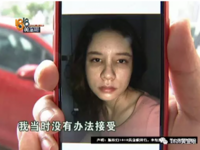 女子花4萬多在寧波首美整形美容醫院做鼻子 術后鼻子卻像被人打過