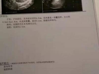崇州蜀都醫院無相關許可證 男子結扎三個月后妻子懷孕