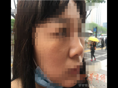 西安藝星美容整形醫(yī)院：醫(yī)美沒有統(tǒng)一標(biāo)準(zhǔn) 鼻子凹凸不平屬于正常