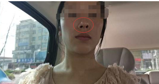 通許協和醫院醫療美容科真大膽 無資質還把人給“毀容”了