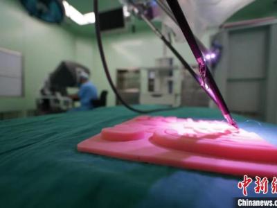 中國(guó)首臺(tái)兒科醫(yī)院達(dá)芬奇手術(shù)機(jī)器人進(jìn)行手術(shù)超100例