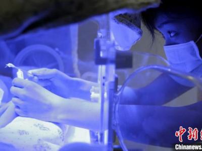 匯報稱：中國極早產(chǎn)兒、極低出世休重早產(chǎn)兒存活率明顯提高