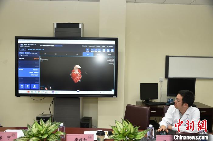 AI系統(tǒng) CT掃描升級  智慧冠脈CT輻射劑量、等候時間雙下降